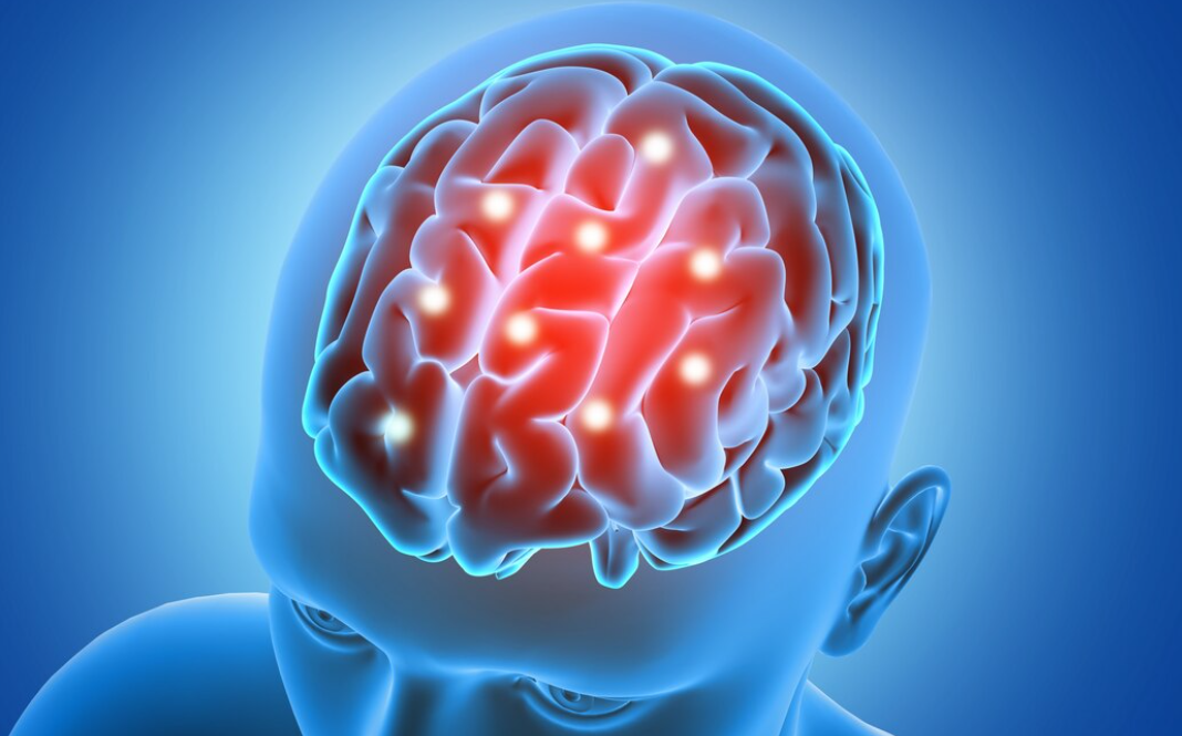 Kecanduan Gadget Diam-Diam Merusak Otak, Ini Penjelasan Lengkapnya